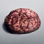 What wet brain is and what the symptoms are