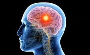The effects of cocaine on the brain